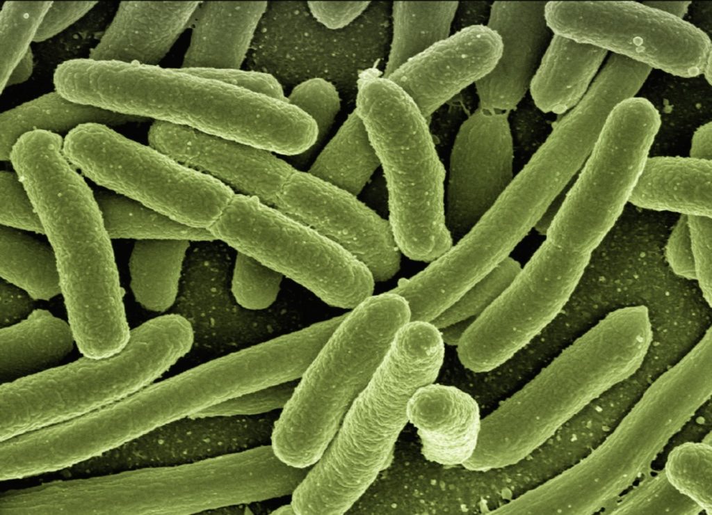 Elektronenmikroskopische Aufnahme von Bakterien, Bakterien sind grün eingefärbt.