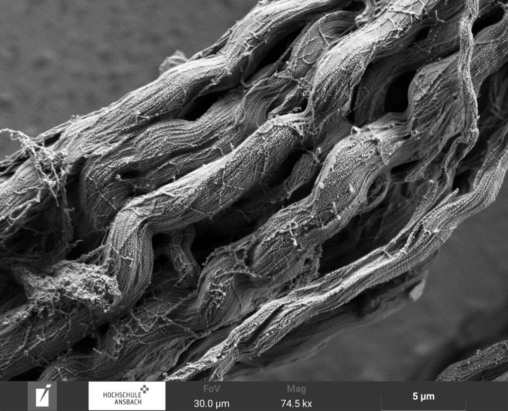 Rasterelektronenmikroskop-Aufnahme von Kollagen-Fasern: Bündel aus mehreren dicken schlauchartigen Strukturen mit leichten Wölbungen und Verdrehungen.