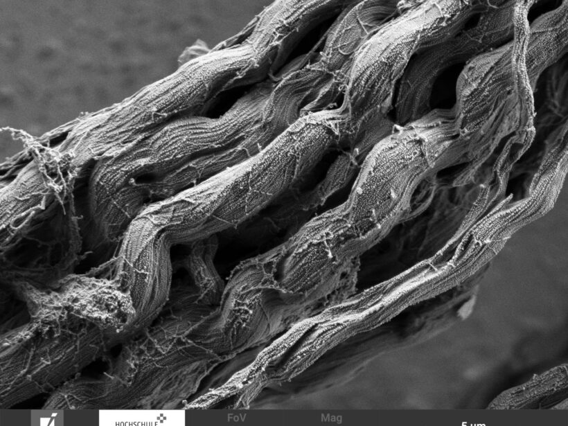 Rasterelektronenmikroskop-Aufnahme von Kollagen-Fasern: Bündel aus mehreren dicken schlauchartigen Strukturen mit leichten Wölbungen und Verdrehungen.