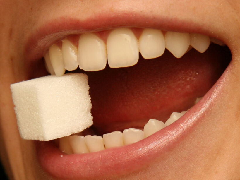 geöffneter weiblicher Mund; die Zähne halten einen Zuckerwürfel.